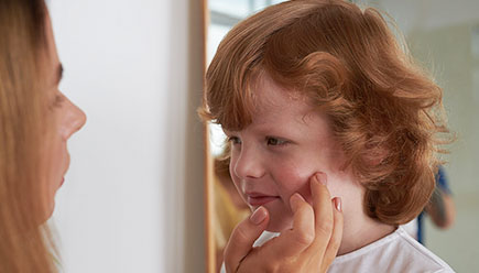 Атопический дерматит