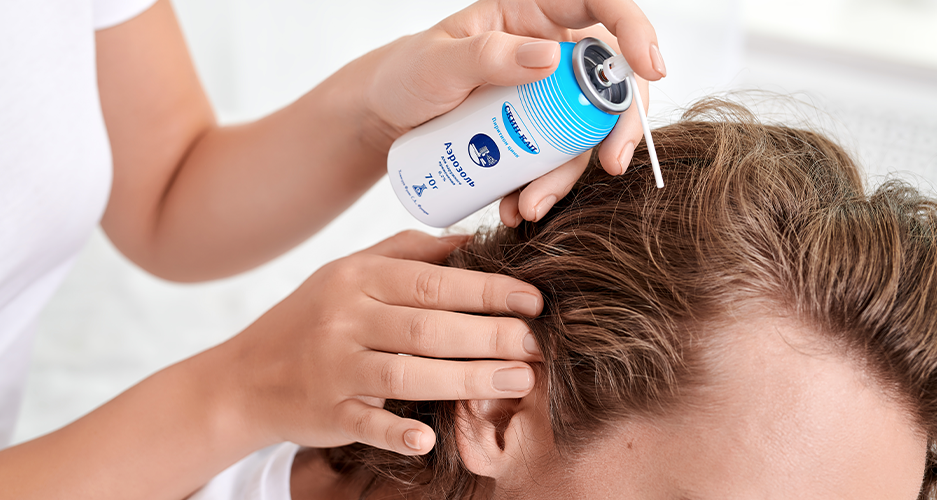 Лечение себореи на голове